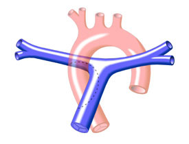 Aortopulmonary Connection