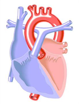 Systemic Hypertension